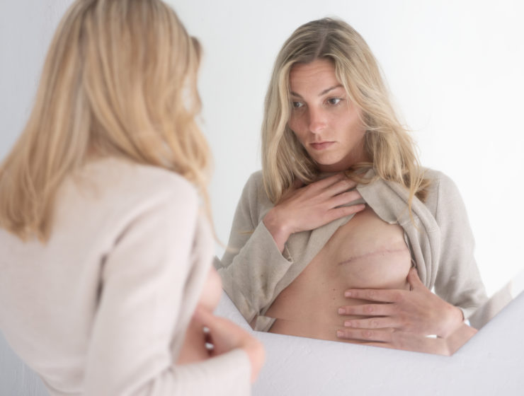 femme devant un miroir après ablation du sein, en réflexion sur la reconstruction mammaire