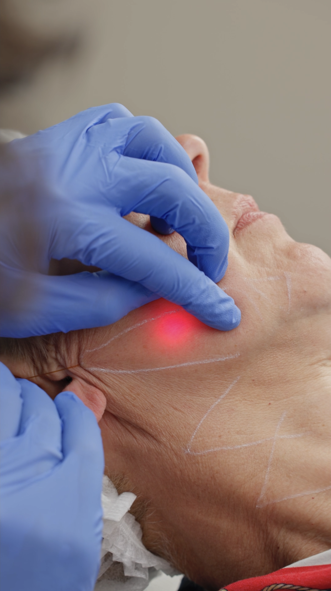 Médecin esthétique pratiquant le traitement Endolift à Genève