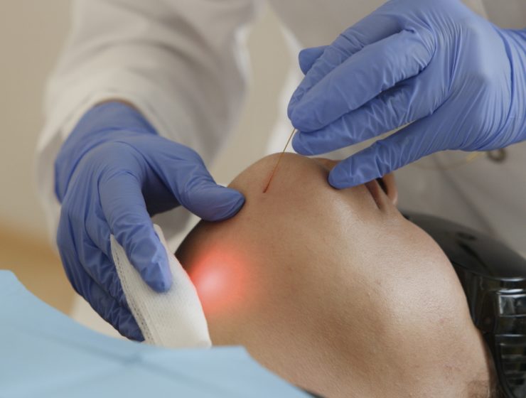 Médecin esthétique pratiquant le traitement Endolift à Genève