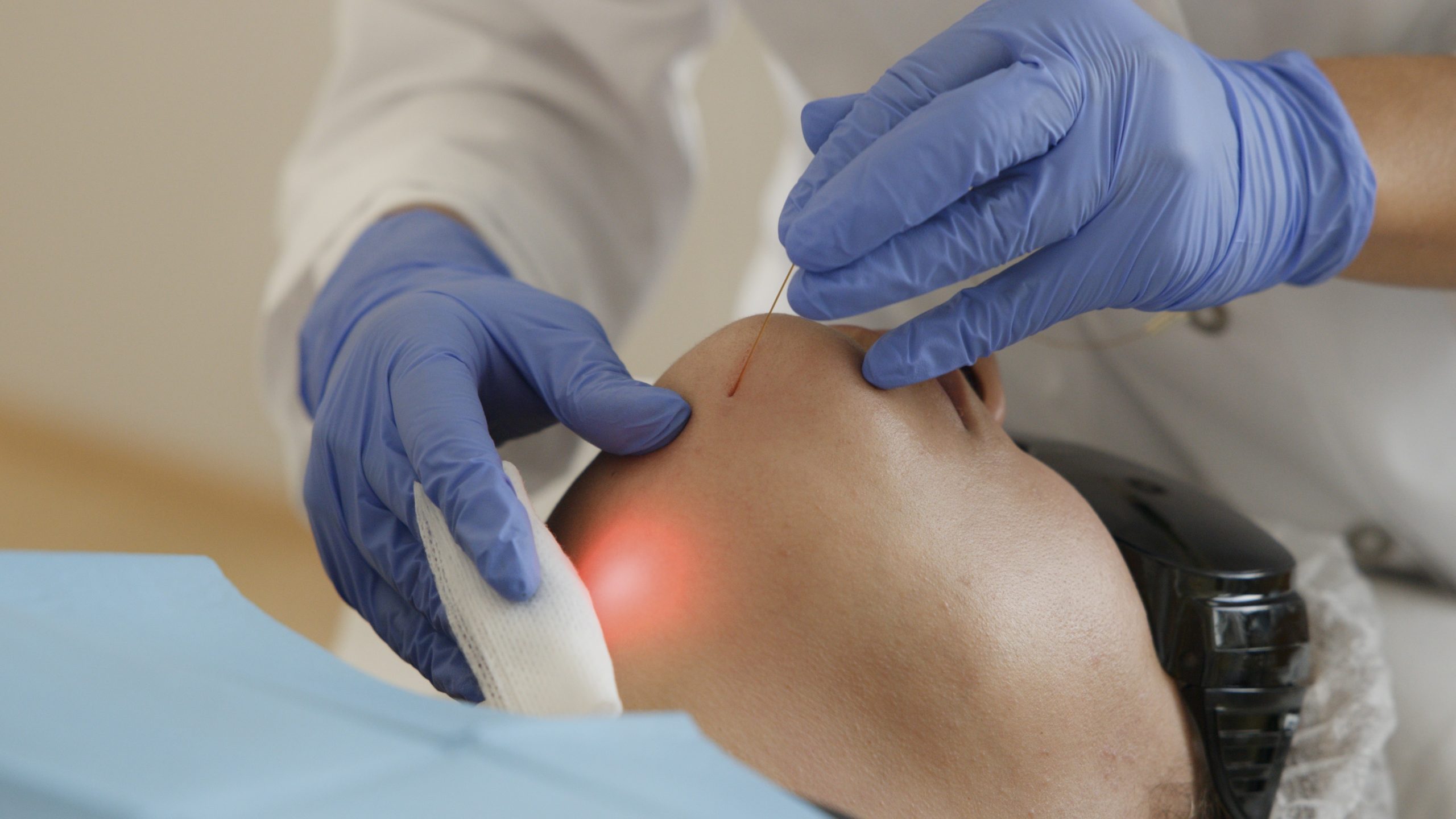 Médecin esthétique pratiquant le traitement Endolift à Genève